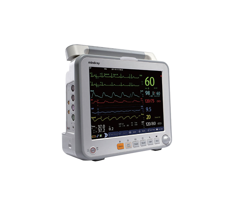 病人监护仪